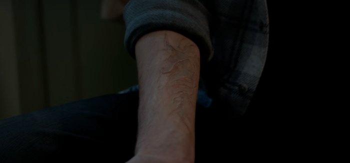 manifest-scar.png