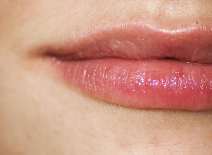 What is a Lip Lift and Why Does the Plastic Surgery Trend Look So Weird?